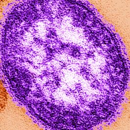 This electron micrograph image shows the measles virus
